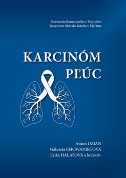 Monografia Karcinóm pľúc